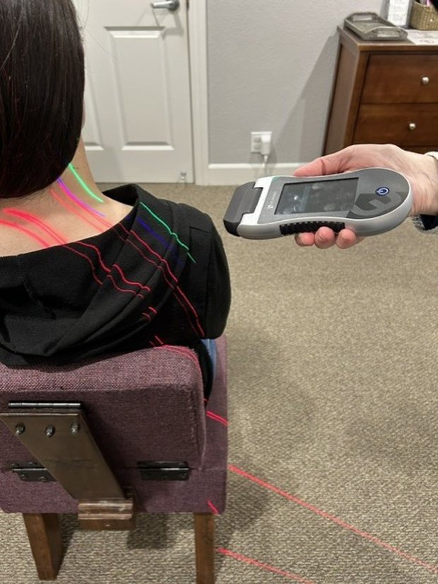 Erchonia cold laser therapy in use at Diablo Chiropractic in Walnut Creek
